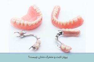 پروتز ثابت و متحرک دندان چیست؟